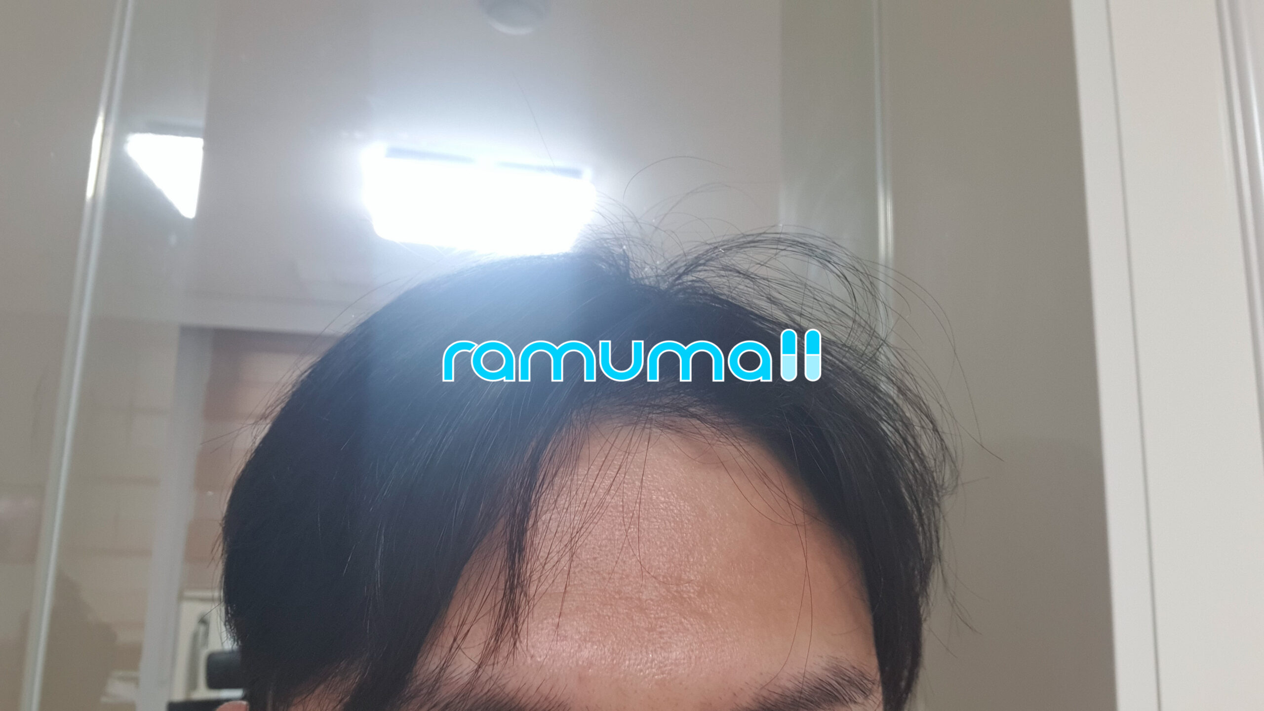 프로페시아 핀페시아 직구 후기