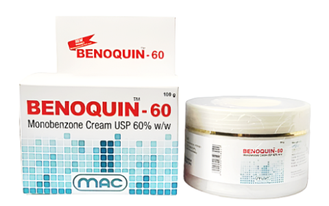 백반증 고농도 모노벤존 크림 베노퀸 BENOQUIN CREAM 40%